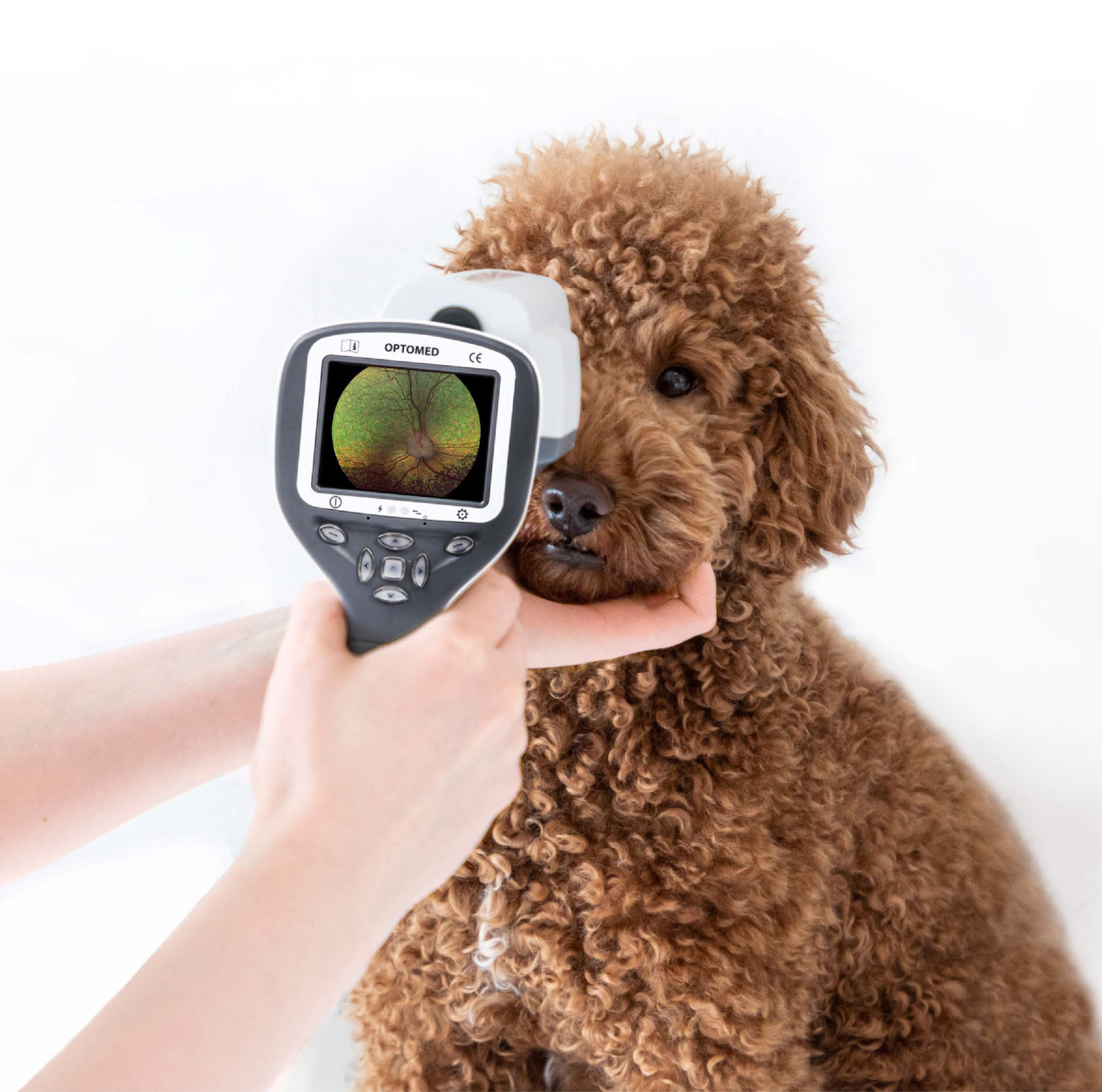 smartscope vision system