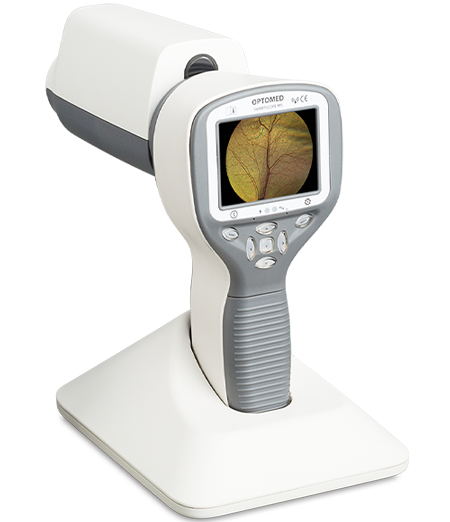 Smartscope PRO handheld fundus camera