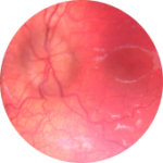 imagen de la retina