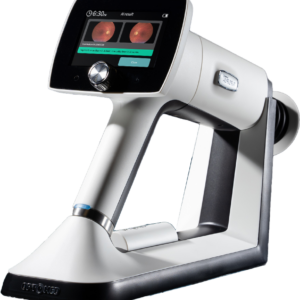 Optomed Aurora AEYE