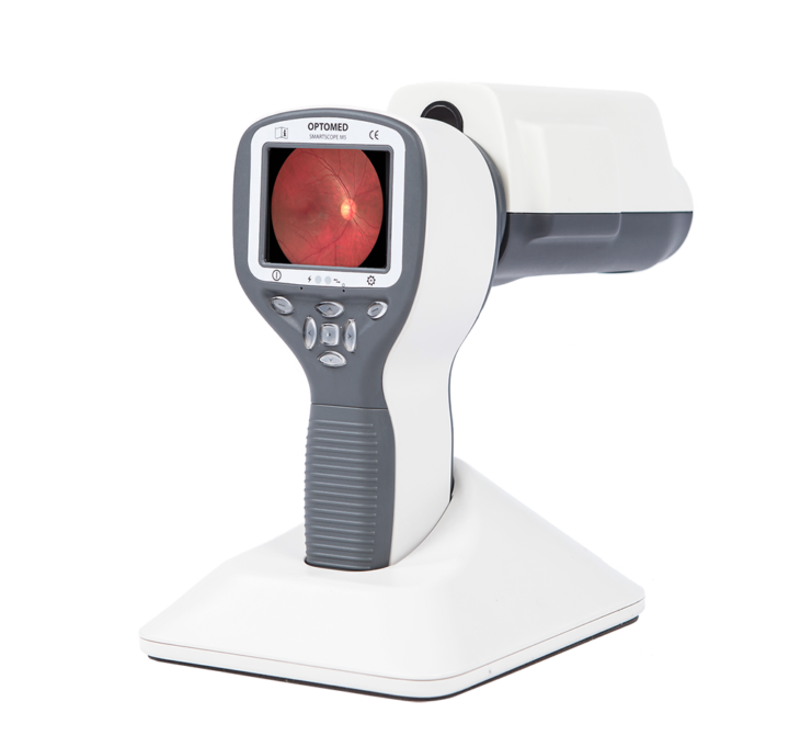 Smartscope PRO Affordable handheld fundus camera