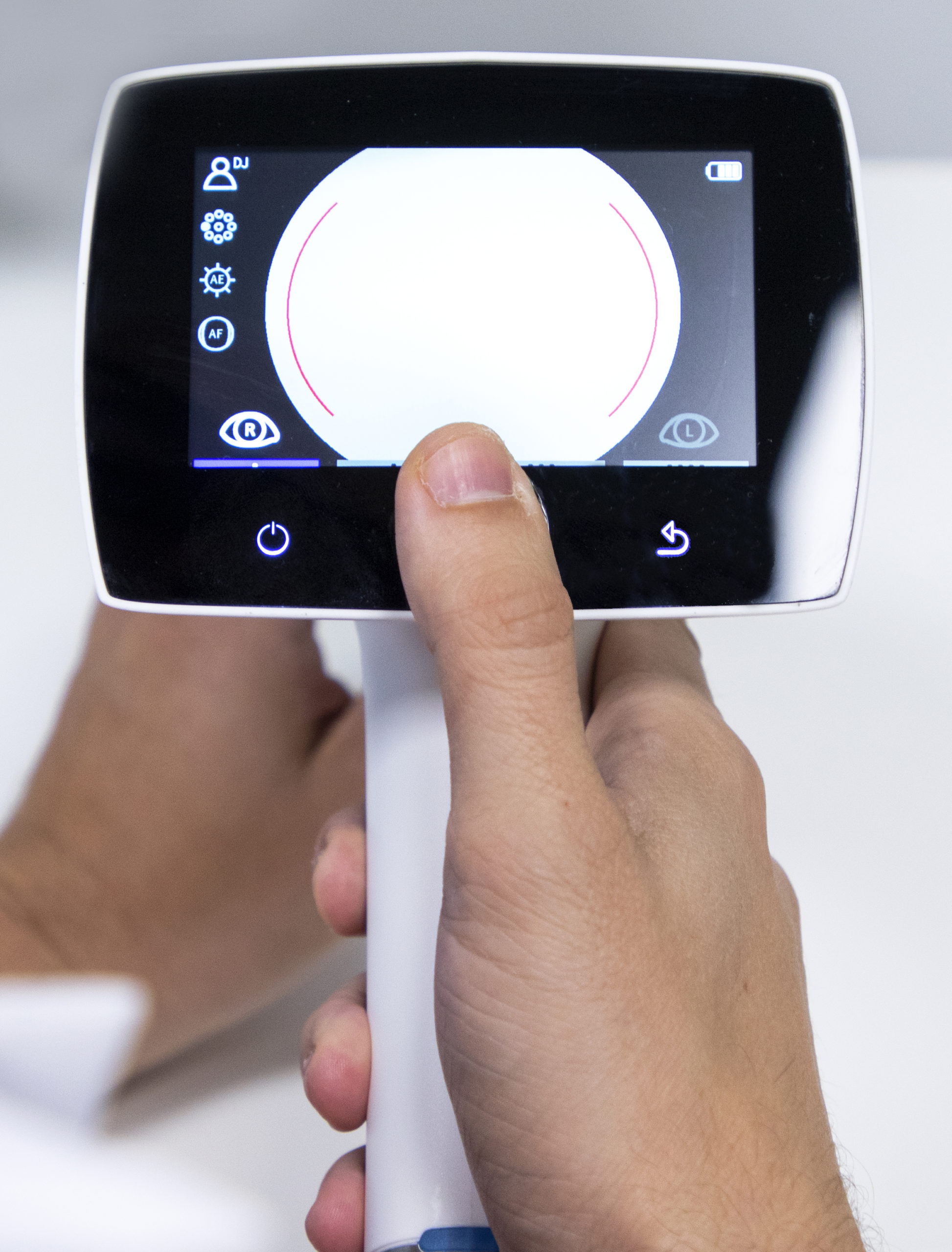 Optomed Aurora IQ software update