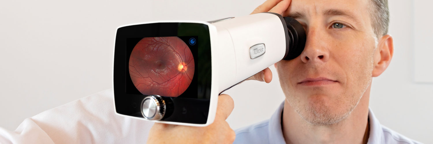 Optomed Aurora IQ fundus camera imaging patients fundus