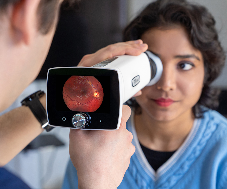 Taking a retinal image with Optomed Aurora IQ handheld fundus camera.