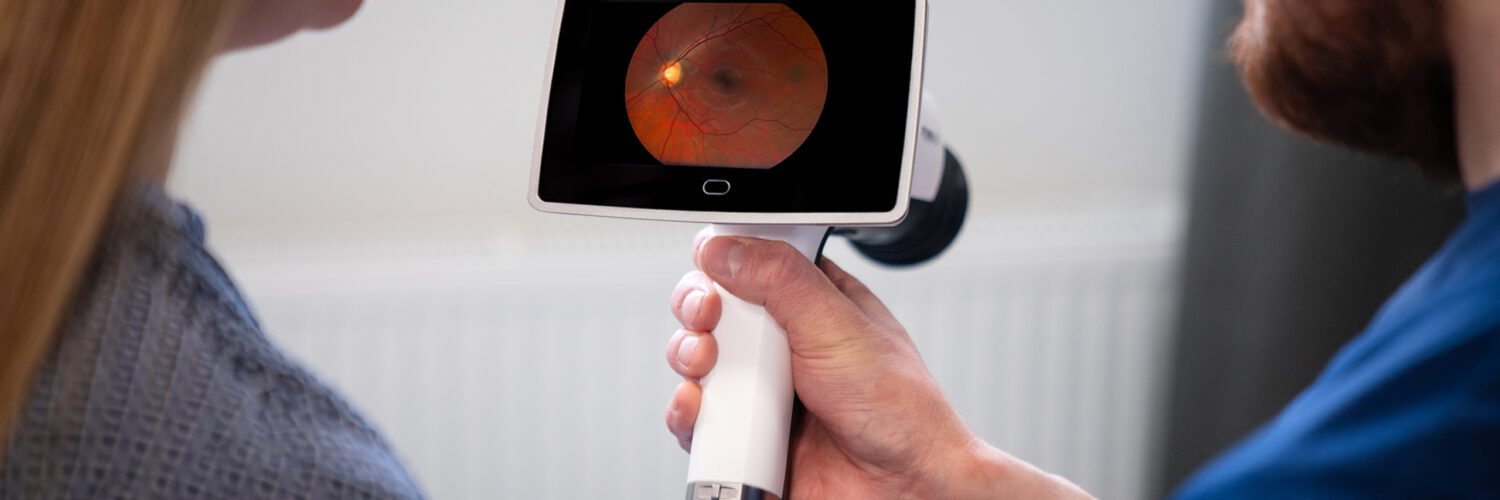 Optomed Lumo - handheld fundus camera, nurse showing eye fundus screening image to patient